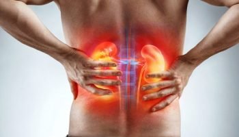 Seis claves para detectar y tratar el cáncer renal, que sigue aumentando en Colombia
