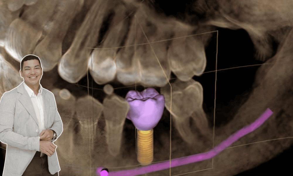 Instituto VITA impulsa Programa de Cooperación para facilitar el acceso a implantes dentales Implantología especializada a un costo más accesible para pacientes