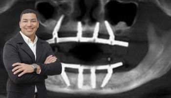 Instituto VITA impulsa programa de cooperación para facilitar el acceso a implantes dentales