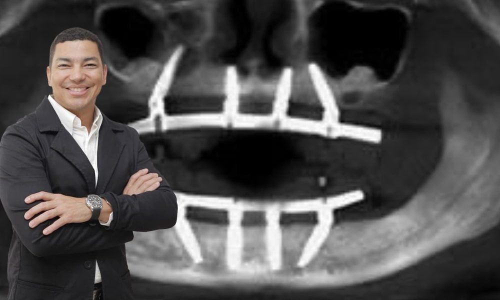 Instituto VITA impulsa programa de cooperación para facilitar el acceso a implantes dentales