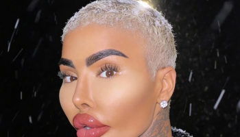 Muere el influencer ‘The Lip King’ tras procedimiento estético en Londres: dos capturados por homicidio involuntario