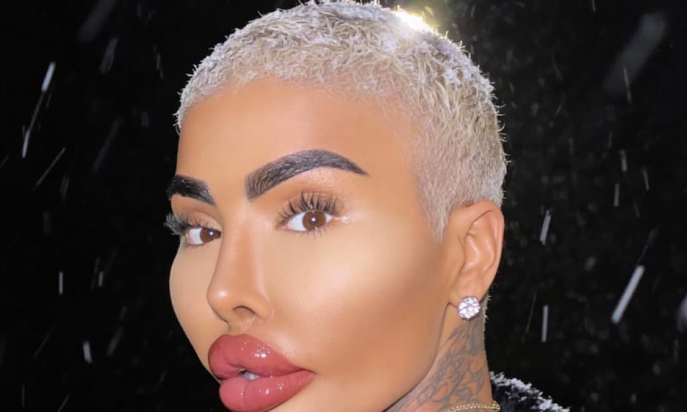 Muere el influencer ‘The Lip King’ tras procedimiento estético en Londres: dos capturados por homicidio involuntario