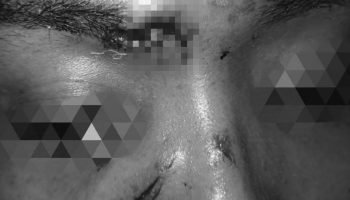 Delincuente intentó hurtar a pasajero de Transcaribe en medio de un transbordo; luego hirió a una mujer con una piedra