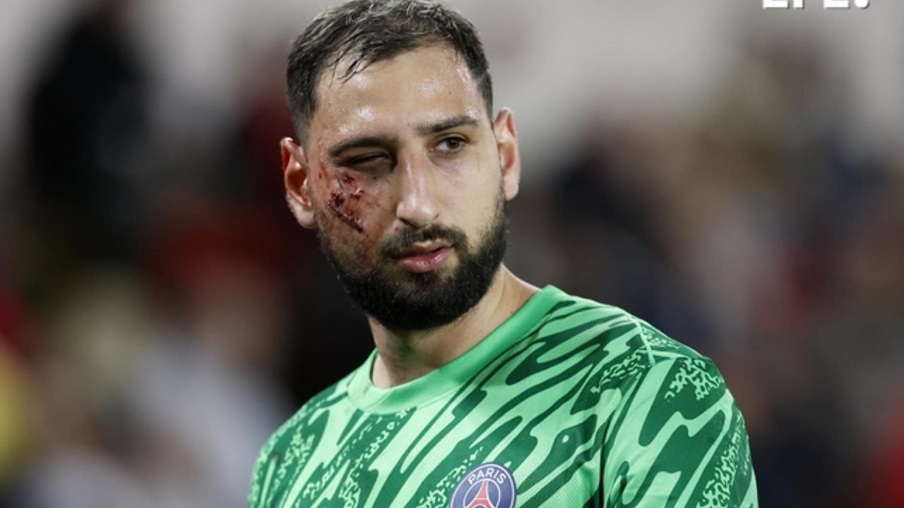 El portero del París Saint Germain (PSG) Gianluigi Donnarumma tras el golpe que ha recibido en el partido contra el Mónaco. EFE/EPA/SEBASTIEN NOGIER